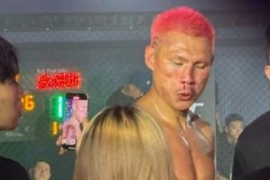 八角笼之战!街球皇帝威姆斯还是猛 恶鼠鼻子都被打歪了 八角笼之战!街球皇帝威姆斯还是猛 恶鼠鼻子都被打歪了