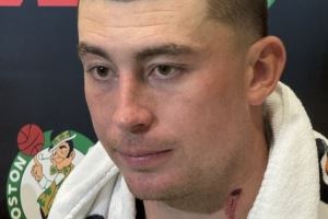 颈部有明显血痕!普理查德:训练营里的对抗像打仗一样 颈部有明显血痕!普理查德:训练营里的对抗像打仗一样